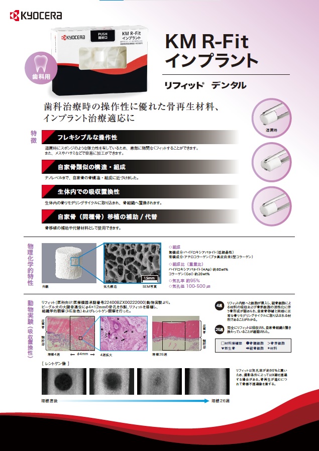 KM R-Fit インプラント リフィット デンタル