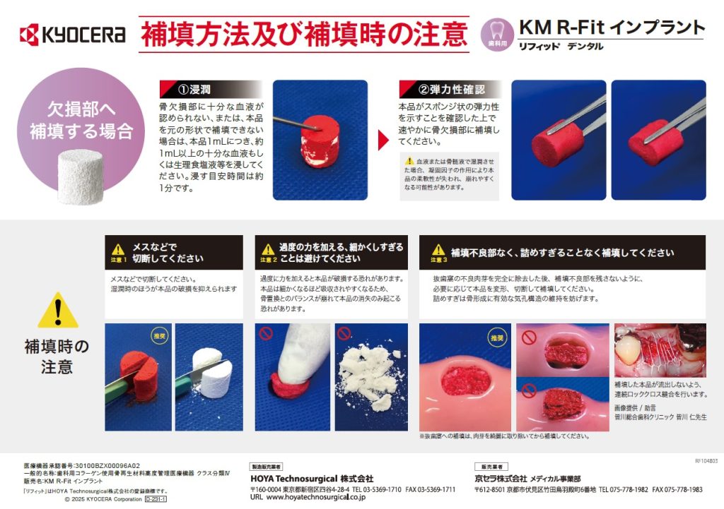KM R-Fit インプラント リフィット デンタル